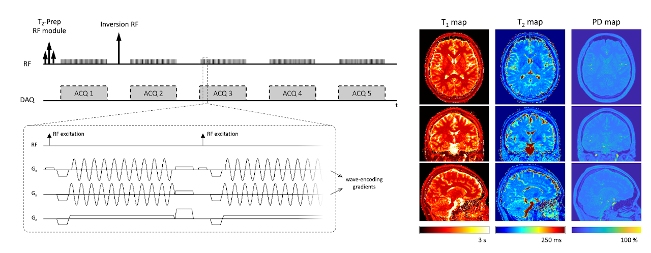 Quantitative MRI